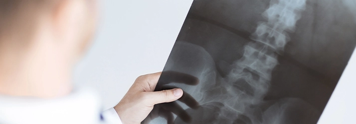 Chiropractic Oakdale MN Digital X-Rays A person holding an image of a X-ray.